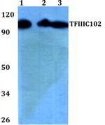 GTF3C3 Antibody in Western Blot (WB)