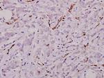 Laminin gamma-1 Antibody in Immunohistochemistry (Paraffin) (IHC (P))