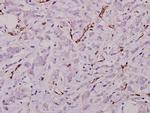 Laminin gamma-1 Antibody in Immunohistochemistry (Paraffin) (IHC (P))