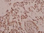 SIAH2 Antibody in Immunohistochemistry (Paraffin) (IHC (P))