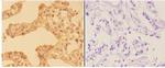 AMPK gamma-1,2,3 Antibody in Immunohistochemistry (Paraffin) (IHC (P))