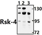 RSK4 Antibody in Western Blot (WB)