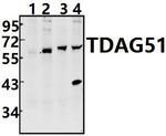 PHLDA1 Antibody in Western Blot (WB)