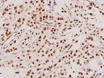 TACC3 Antibody in Immunohistochemistry (Paraffin) (IHC (P))