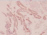 UCP2 Antibody in Immunohistochemistry (Paraffin) (IHC (P))