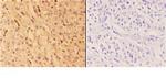 ACOT2 Antibody in Immunohistochemistry (Paraffin) (IHC (P))