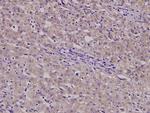 B4GALT3 Antibody in Immunohistochemistry (Paraffin) (IHC (P))