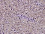 B4GALT3 Antibody in Immunohistochemistry (Paraffin) (IHC (P))