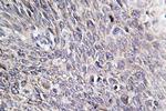 CHPF Antibody in Immunohistochemistry (Paraffin) (IHC (P))