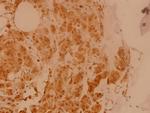 eIF5B Antibody in Immunohistochemistry (Paraffin) (IHC (P))