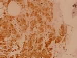 eIF5B Antibody in Immunohistochemistry (Paraffin) (IHC (P))