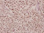 GABRG1 Antibody in Immunohistochemistry (Paraffin) (IHC (P))