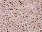 GABRG1 Antibody in Immunohistochemistry (Paraffin) (IHC (P))