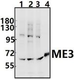 ME3 Antibody in Western Blot (WB)