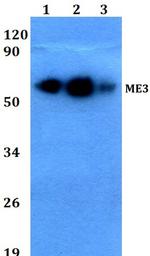 ME3 Antibody in Western Blot (WB)