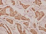 DDX52 Antibody in Immunohistochemistry (Paraffin) (IHC (P))