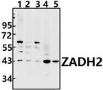 ZADH2 Antibody in Western Blot (WB)