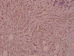 IL4R Antibody in Immunohistochemistry (Paraffin) (IHC (P))