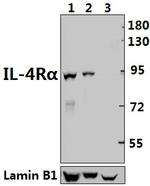 IL4R Antibody in Western Blot (WB)