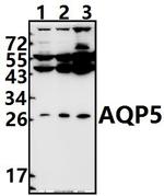 Aquaporin 5 Antibody in Western Blot (WB)