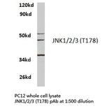 JNK1/JNK2/JNK3 Antibody in Western Blot (WB)