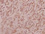 RPL7 Antibody in Immunohistochemistry (Paraffin) (IHC (P))