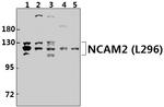 NCAM2 Antibody in Western Blot (WB)