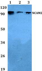 NCAM2 Antibody in Western Blot (WB)