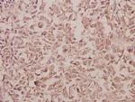 RAB5C Antibody in Immunohistochemistry (Paraffin) (IHC (P))