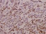 OATP1 Antibody in Immunohistochemistry (Paraffin) (IHC (P))