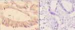 Phospho-ADD1/ADD2 (Ser726, Ser713) Antibody in Immunohistochemistry (Paraffin) (IHC (P))