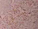 Phospho-ATF2 (Thr69) Antibody in Immunohistochemistry (Paraffin) (IHC (P))