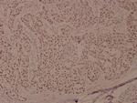 Phospho-BRCA1 (Ser1524) Antibody in Immunohistochemistry (Paraffin) (IHC (P))