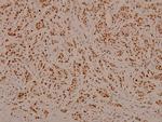 Phospho-C/EBP beta (Thr188, Thr235) Antibody in Immunohistochemistry (Paraffin) (IHC (P))