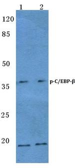 Phospho-C/EBP beta (Thr188, Thr235) Antibody in Western Blot (WB)