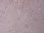 Phospho-ELK1 (Ser389) Antibody in Immunohistochemistry (Paraffin) (IHC (P))