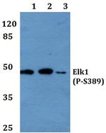 Phospho-ELK1 (Ser389) Antibody in Western Blot (WB)