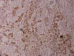 Phospho-ELK1 (Thr417) Antibody in Immunohistochemistry (Paraffin) (IHC (P))