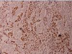 Phospho-ELK1 (Thr417) Antibody in Immunohistochemistry (Paraffin) (IHC (P))