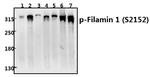 Phospho-Filamin A (Ser2152) Antibody in Western Blot (WB)