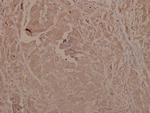 Phospho-GSK3 alpha/beta (Tyr279, Tyr216) Antibody in Immunohistochemistry (Paraffin) (IHC (P))