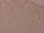 Phospho-IKK beta (Tyr188) Antibody in Immunohistochemistry (Paraffin) (IHC (P))