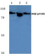 Phospho-IKK beta (Tyr188) Antibody in Western Blot (WB)