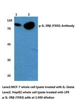 Phospho-CSF2RB (Tyr593) Antibody in Western Blot (WB)