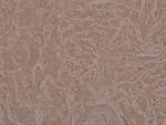 Phospho-JAK1 (Tyr1022) Antibody in Immunohistochemistry (Paraffin) (IHC (P))