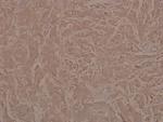 Phospho-JAK1 (Tyr1022) Antibody in Immunohistochemistry (Paraffin) (IHC (P))