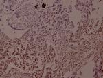 Phospho-JunD (Ser255) Antibody in Immunohistochemistry (Paraffin) (IHC (P))