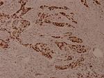 Phospho-MEF2A (Ser408) Antibody in Immunohistochemistry (Paraffin) (IHC (P))