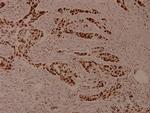 Phospho-MEF2A (Ser408) Antibody in Immunohistochemistry (Paraffin) (IHC (P))