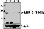 Phospho-MEF2A (Ser408) Antibody in Western Blot (WB)